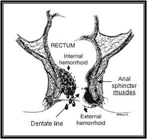 Hemorrhoid anatomy